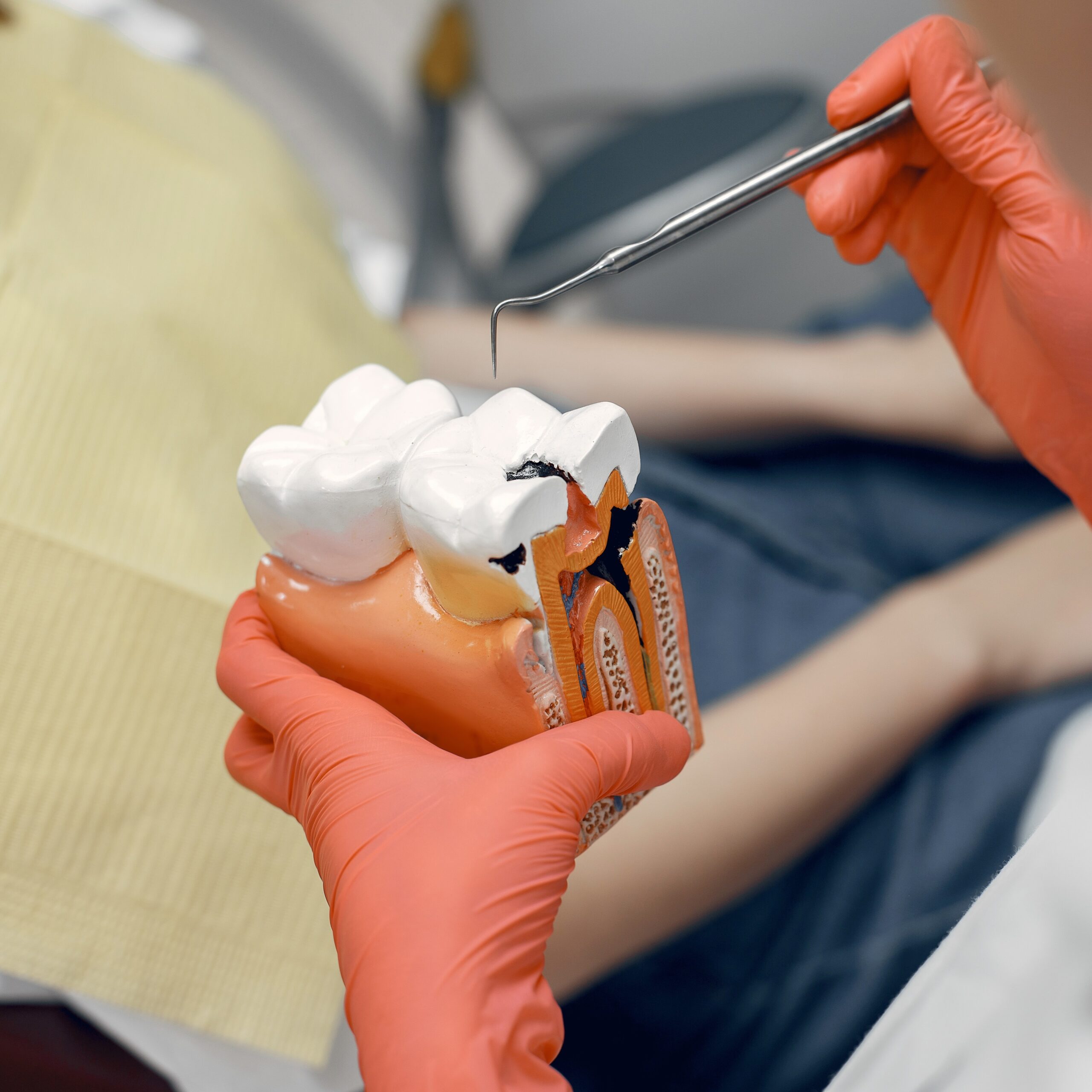 Endodoncia en Antofagasta